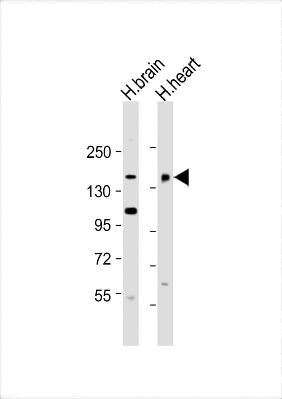 Polyclonal Rabbit anti-Human MTUS2 Antibody (C-Terminus, WB)