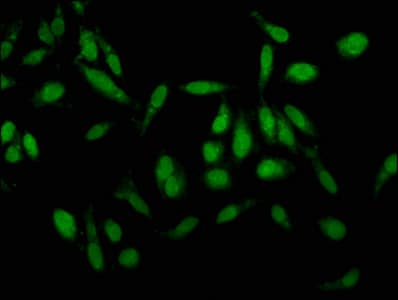 IHC-plus™ Polyclonal Rabbit anti-Human KLK1 / Kallikrein 1 Antibody (aa25-262, IHC)