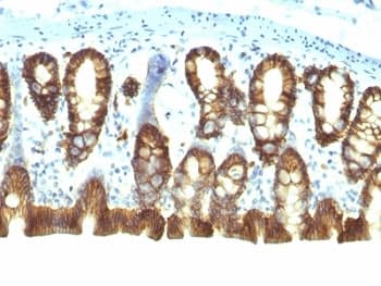 EPCAM Antibody (Cytoplasmic Domain, clone EGP40/1110, Ready-to-Use)