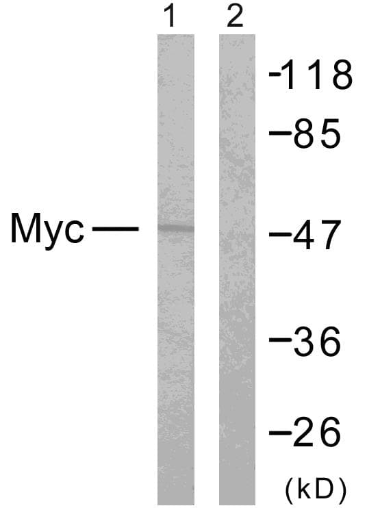 Polyclonal Rabbit anti-Human MYC / c-Myc Antibody (aa325-374, IHC, WB)