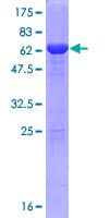 Human PCBP3 Protein (Recombinant GST)