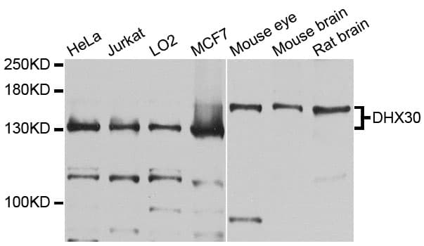 Polyclonal Rabbit anti-Human DHX30 Antibody (WB)