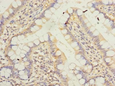KLHDC8A Antibody