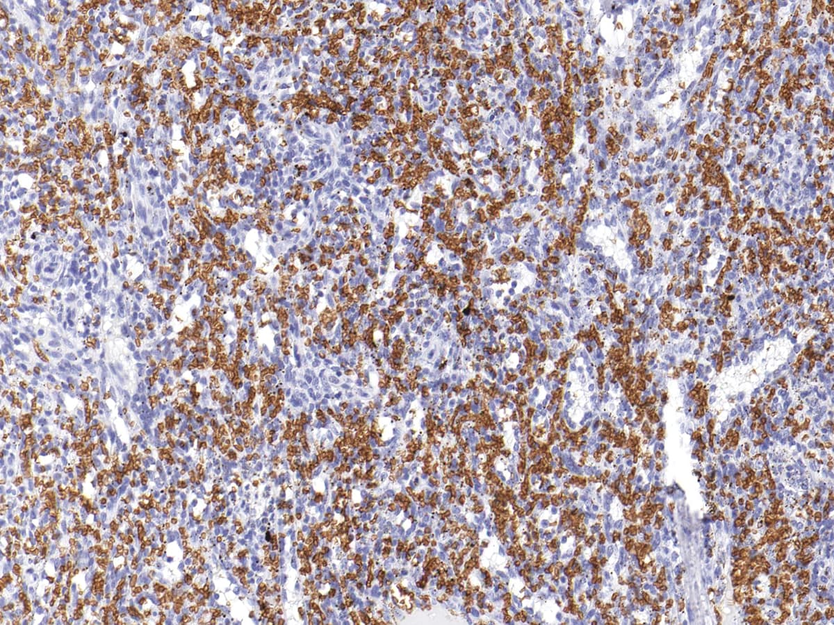 Glycophorin A+B Antibody (Concentrated)