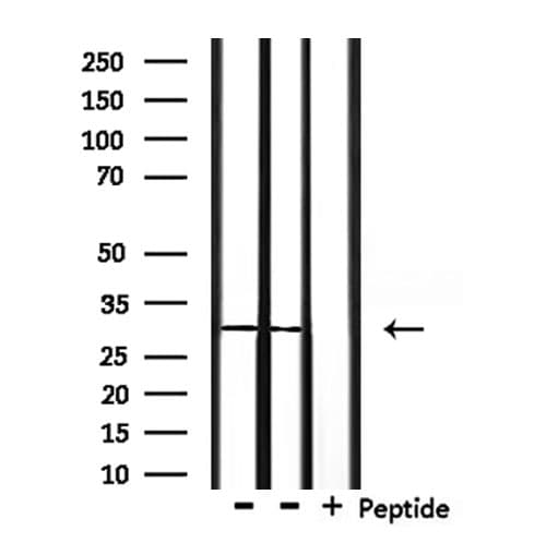 Polyclonal Rabbit anti-Human OTUB1 / OTU1 Antibody (IHC, IF, WB)