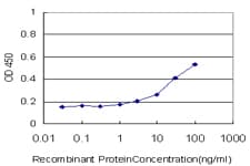 IHC-plus™ ALOX15 / 15-Lipoxygenase Antibody (clone 3D8)