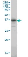Monoclonal Mouse anti-Human CA8 / Carbonic Anhydrase VIII Antibody (clone 1F7, WB)