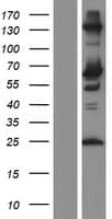 Human SCP2 / SCPX Protein (Over-Expression Lysate Myc-DDK (Flag))