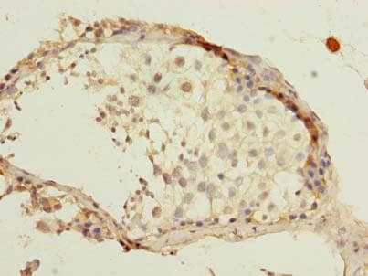 Polyclonal Rabbit anti-Human MAGOHB / Mago Antibody (IHC)