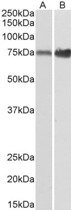 IHC-plus™ XPNPEP1 / Aminopeptidase P Antibody (aa655-666)