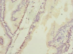 DHAND / HAND2 Antibody