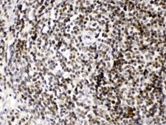 HMG2 / HMGB2 Antibody