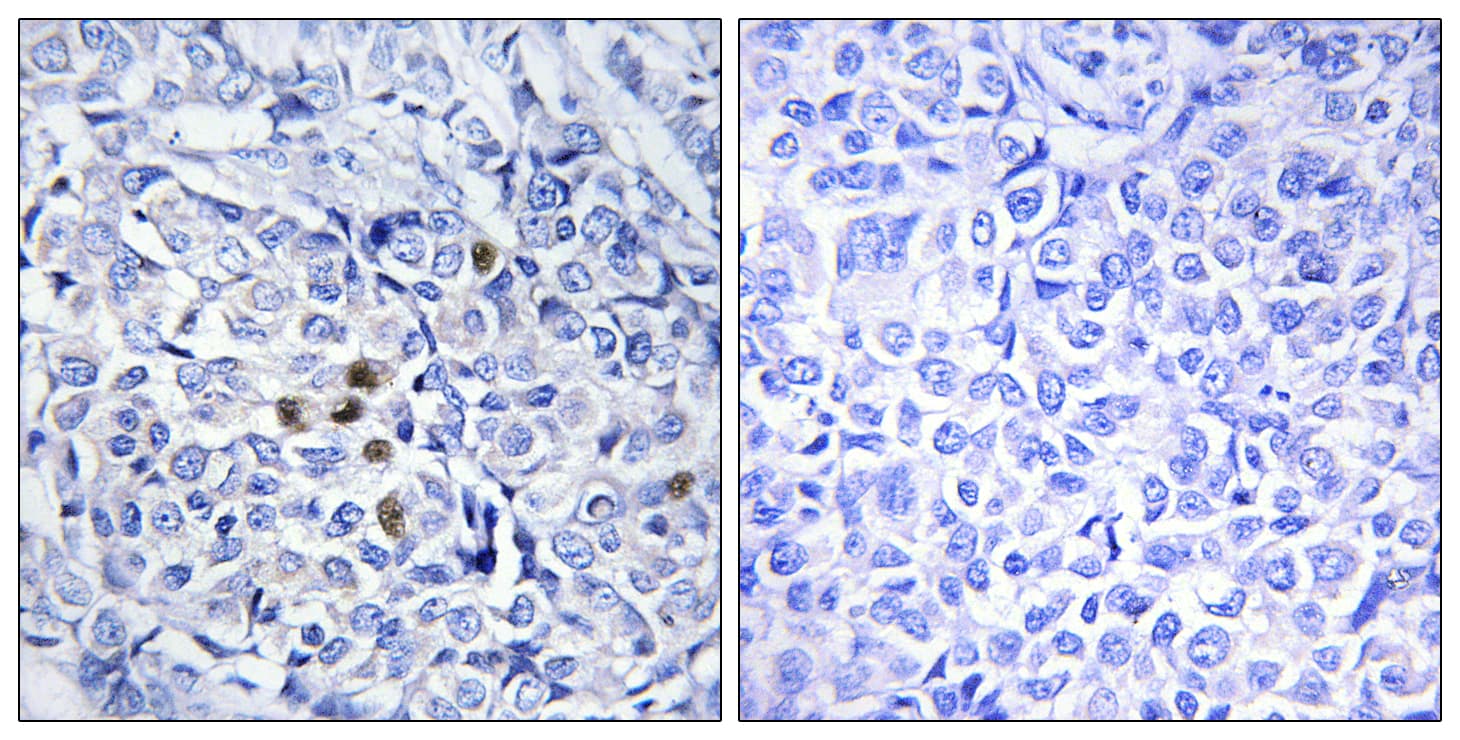 Polyclonal Rabbit anti-Human PLK1 / PLK-1 Antibody (phospho-Thr210, IHC)