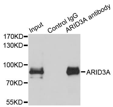 Polyclonal Rabbit anti-Human ARID3A / DRIL1 Antibody (IHC, WB)