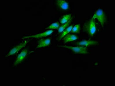 Polyclonal Rabbit anti-Human HECTD2 Antibody (IHC, IF)