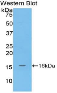 MGP / Matrix Gla-Protein Antibody (aa1-103)