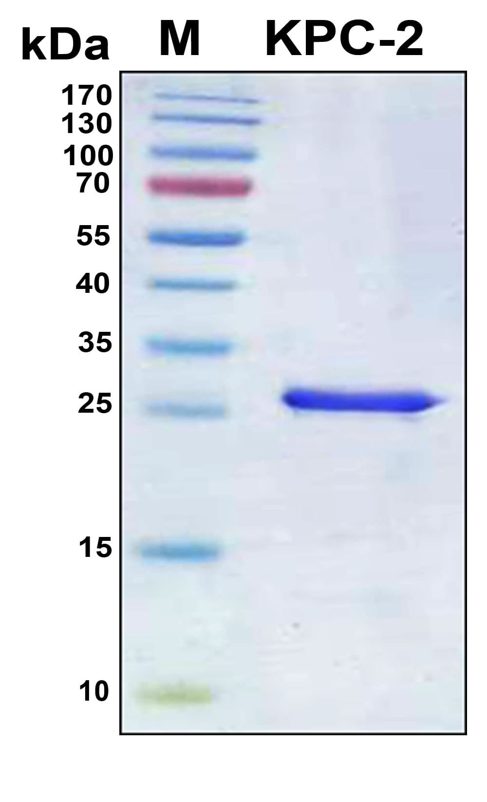 Klebsiella pneumoniae Beta-lactamase KPC-2 Protein (Recombinant 6His, N-terminus)