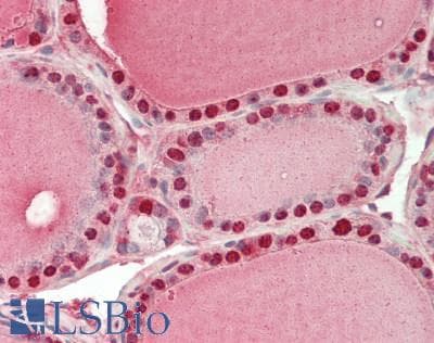 Polyclonal Rabbit anti-Human GSTP1 / GST Pi Antibody (aa1-210, IHC, WB)