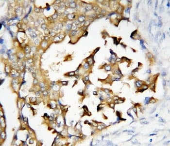 PSEN2 / Presenilin 2 Antibody (aa39-51)
