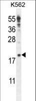Polyclonal Rabbit anti-Human IQCJ Antibody (aa98-126, IHC, WB)