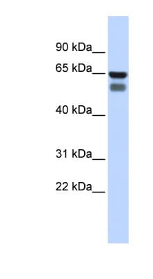 GALNT4 Antibody (aa360-409)