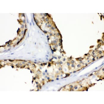 HSP90AA1 / Hsp90 Alpha A1 Antibody (aa454-488)