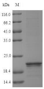 Arabidopsis thaliana LYSMD1 Protein (Recombinant 10His, N-terminus + Myc, C-terminus)