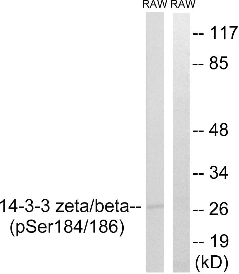 14-3-3 Beta + Zeta Antibody (phospho-Ser184/186)