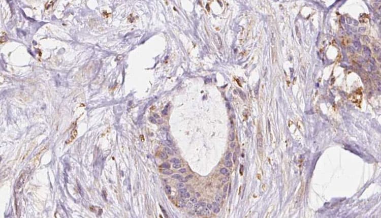 EXOC1 / SEC3 Antibody