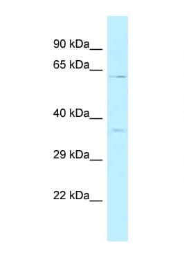 BRCC3 / BRCC36 Antibody (C-Terminus)