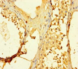 Polyclonal Rabbit anti-Human SPATS1 Antibody