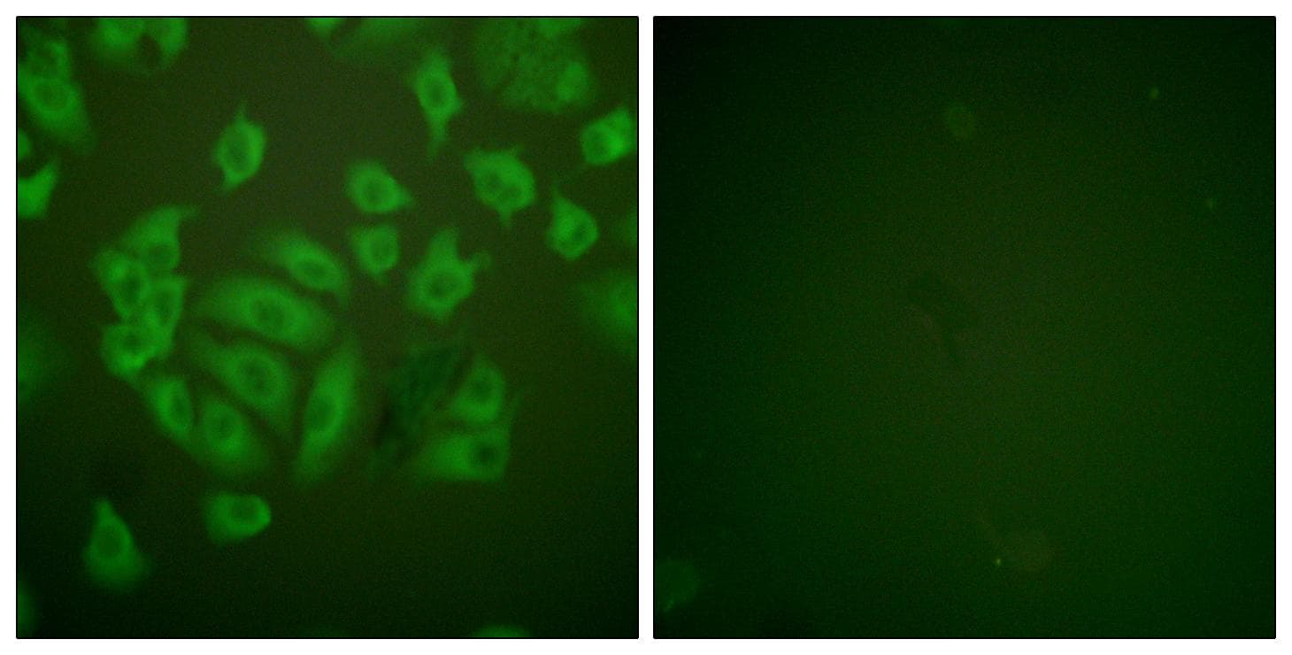 CSTA / Cystatin A Antibody