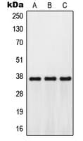 GPR171 Antibody (Internal)