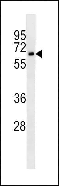 IL2RA / CD25 Antibody