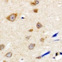 NBPF5P Antibody (C-Terminus)