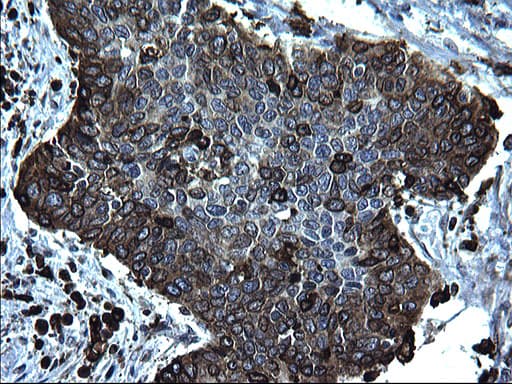 CD74 / CLIP Antibody (clone OTI1H3)