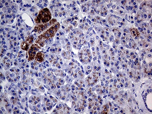 GALNT10 Antibody (aa1-318, clone OTI2A12)