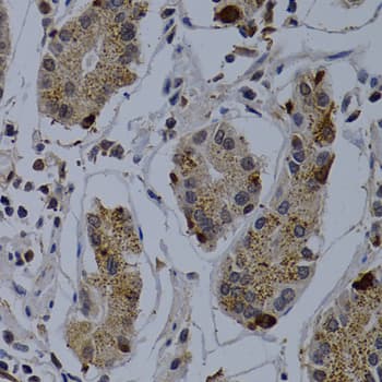 IHC-plus™ Polyclonal Rabbit anti-Human TNFRSF6B / DCR3 Antibody (IHC, WB)