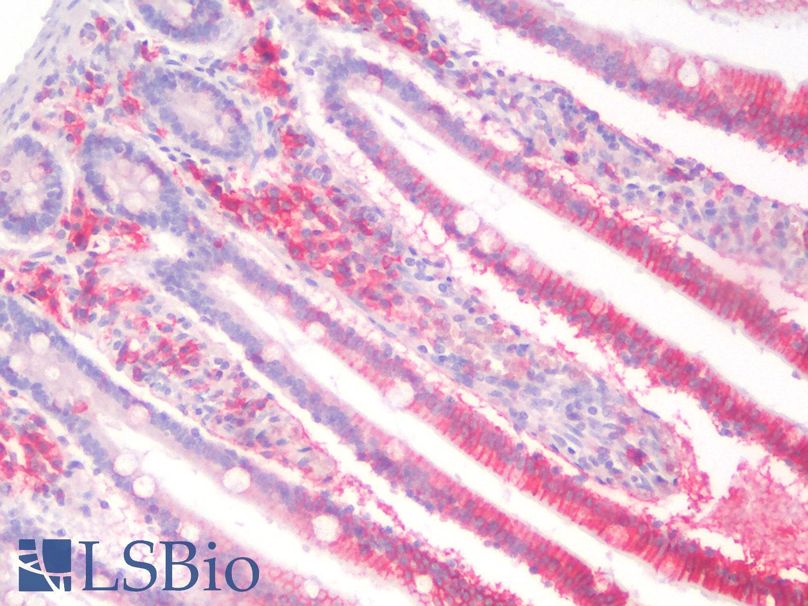 PathPlus™ Polyclonal Rabbit anti-Human KRAS Antibody (IHC)