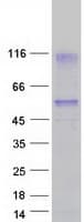 Human HAVCR1 / KIM-1 Protein (Recombinant Myc-DDK (Flag))