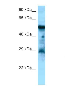 Polyclonal Rabbit anti-Human CCKBR / Cckb Antibody (aa277-326, WB)