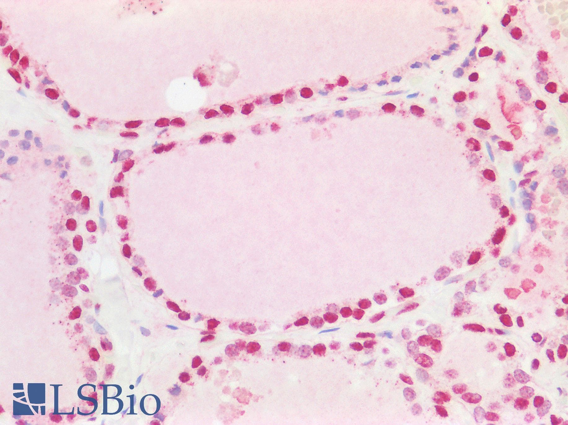 IHC-plus™ MED13L Antibody (aa550-600)