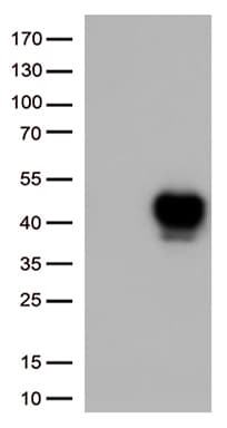 Monoclonal Mouse anti-Human TNFRSF4 / CD134 / OX40 Antibody (clone UMAB277, IHC, WB)