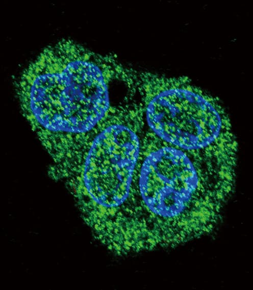 IHC-plus™ SFTPC / Surfactant Protein C Antibody (aa144-173)