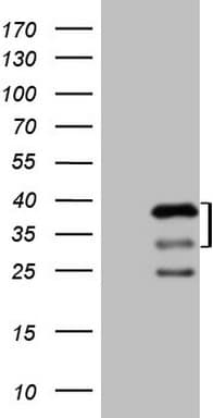 PRKAB2 / AMPK Beta 2 Antibody (clone OTI4H4)