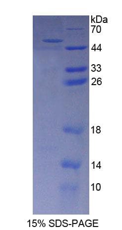 Mouse AASS / LKR / SDH Protein (Recombinant His-T7)