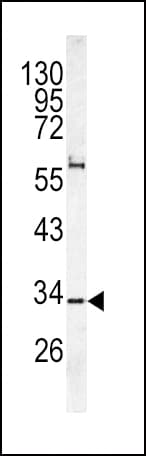 CACNG5 Antibody (aa192-220)