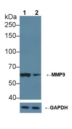 MMP9 / Gelatinase B Antibody (aa226-391)