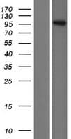 INVS / Inversin Protein (Over-Expression Lysate Myc-DDK (Flag))