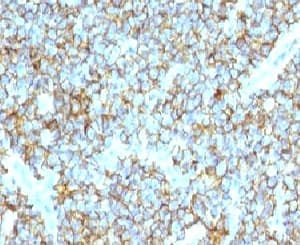 CD99 Antibody (clone CDLA99)